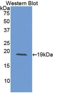 IL15 Antibody (aa49-162)