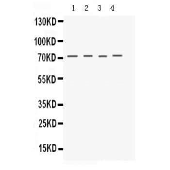KCNA4 / Kv1.4 Antibody (aa609-647)