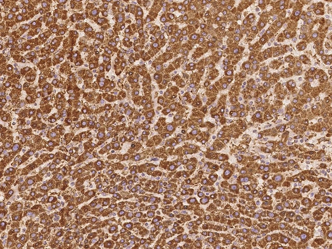 Polyclonal Rabbit anti-Human DNAH8 Antibody (IHC)