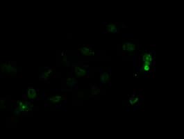 GPR49 / LGR5 Antibody (aa250-550, clone OTI11B5)