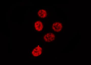 NFKB1 / NF-Kappa-B Antibody