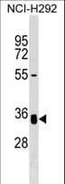 Polyclonal Rabbit anti-Human GNPTG Antibody (aa266-296, WB)