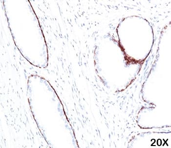 Keratin, HMW Antibody (clone 34BE12)