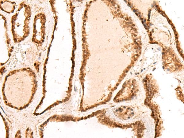 FAM134B Antibody