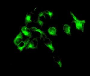 IHC-plus™ FADS1 Antibody (Internal, clone EPR6898)