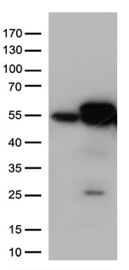 Monoclonal Mouse anti-Human CALR / Calreticulin Antibody (clone OTI6H10, WB)