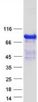 Human ARHGAP24 Protein (Recombinant Myc-DDK (Flag))