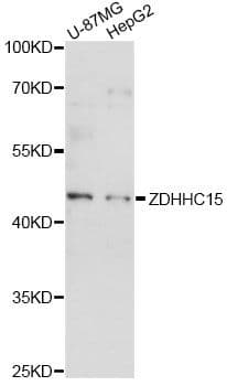 ZDHHC15 Antibody