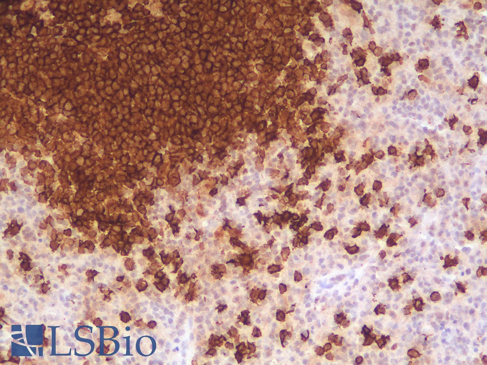 PathPlus™ CD20 Antibody (clone rIGEL/773)