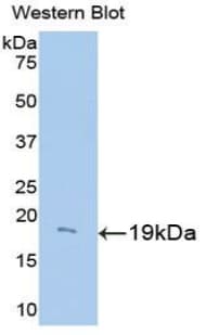 UCP2 Antibody (aa150-304, PE)