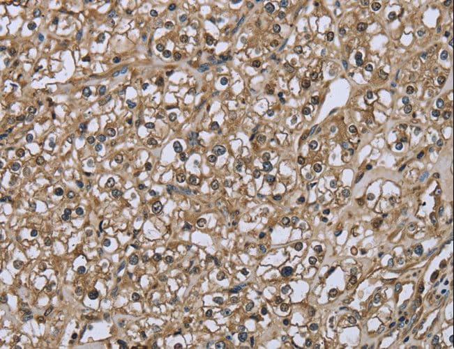 FBP1 Antibody