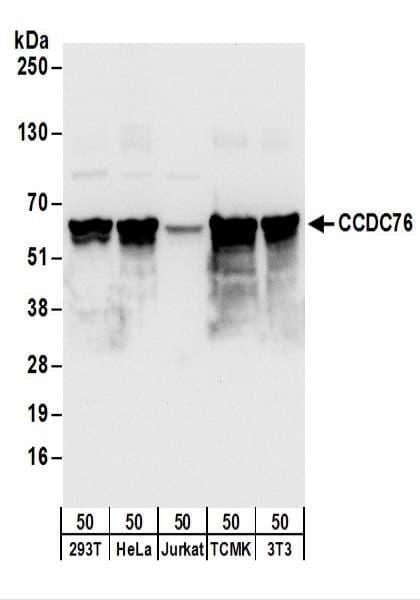 Polyclonal Rabbit anti-Human CCDC76 Antibody (aa25-75, WB)
