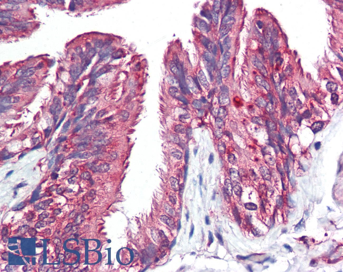 IHC-plus™ EIF4B Antibody (aa570-630)