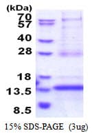 Human CDKN2AIPNL Protein (Recombinant His)