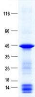 Human BGN / Biglycan Protein (Recombinant His, N-Terminal)