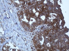 TAPBPL / TAPBPR Antibody (clone OTI2D6)