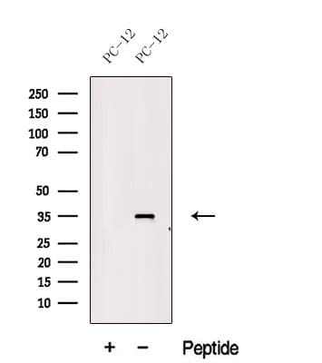 Polyclonal Rabbit anti-Human MSI2 Antibody (WB)