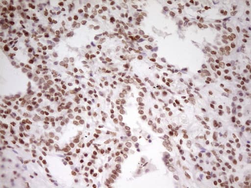 Monoclonal Mouse anti-Human SP110 Antibody (clone OTI4C1, aa232-521, IHC, WB)