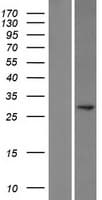 POMC / Proopiomelanocortin Protein (Over-Expression Lysate Myc-DDK (Flag))