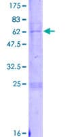 Human DPS / PDSS1 Protein (Recombinant GST)