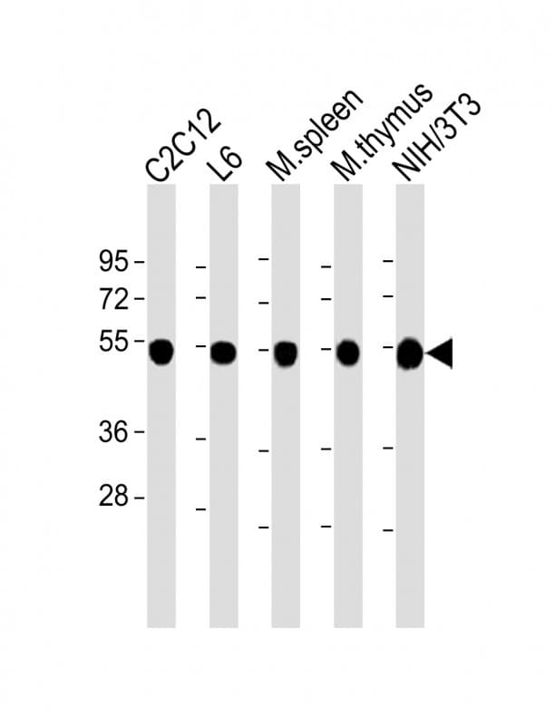 Tubulin beta-5 chain Antibody