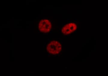 HNRNPC / HNRNP C Antibody