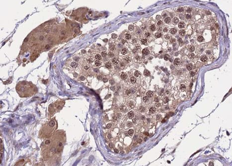 Polyclonal Rabbit anti-Human SREBF2 / SREBP2 Antibody (IHC, WB)