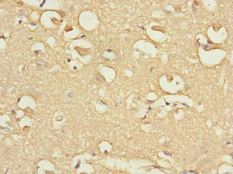 FBXO4 / FBX4 Antibody