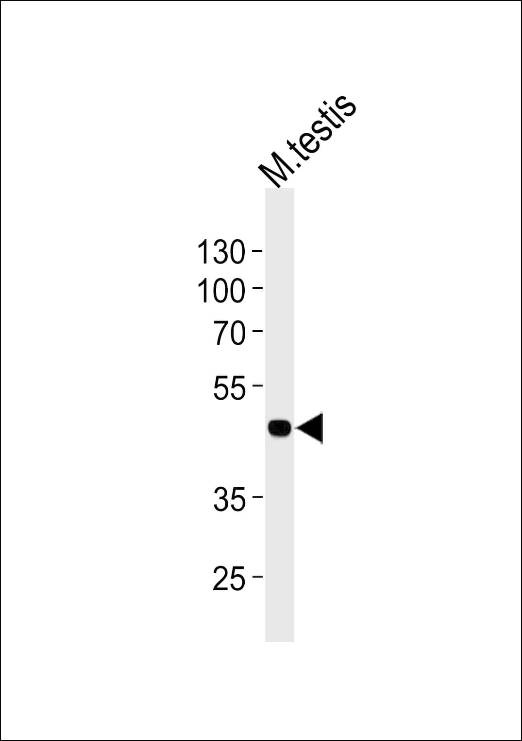 MOS Antibody (aa301-329)