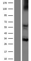 NOX3 Protein (Over-Expression Lysate Myc-DDK (Flag))