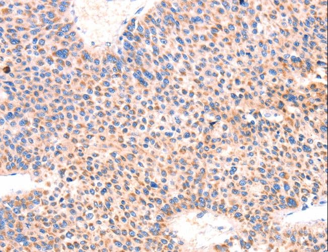 AMPD1 Antibody