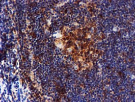 LIMK1 / LIMK Antibody (clone OTI6B4)