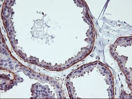 Monoclonal Mouse anti-Human VASP Antibody (clone OTI1F3, IHC, WB)