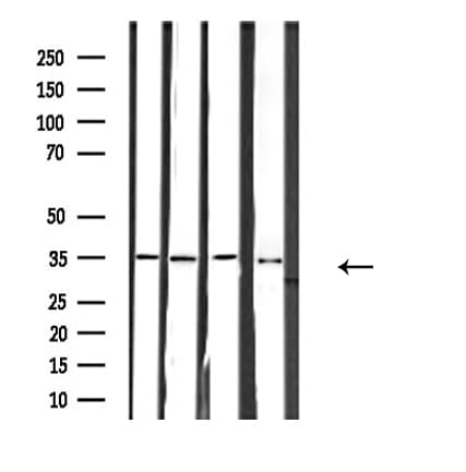 RNF113B Antibody