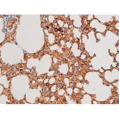 Polyclonal Rabbit anti-Human GATA4 Antibody (phospho-Ser262, IHC, IF, WB)