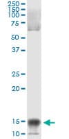 NIP45 / NFATC2IP Antibody (clone 3E9-B7)