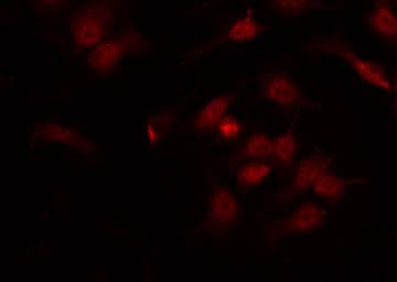Polyclonal Rabbit anti-Human IRF3 Antibody (phospho-Ser385, IHC, IF, WB)