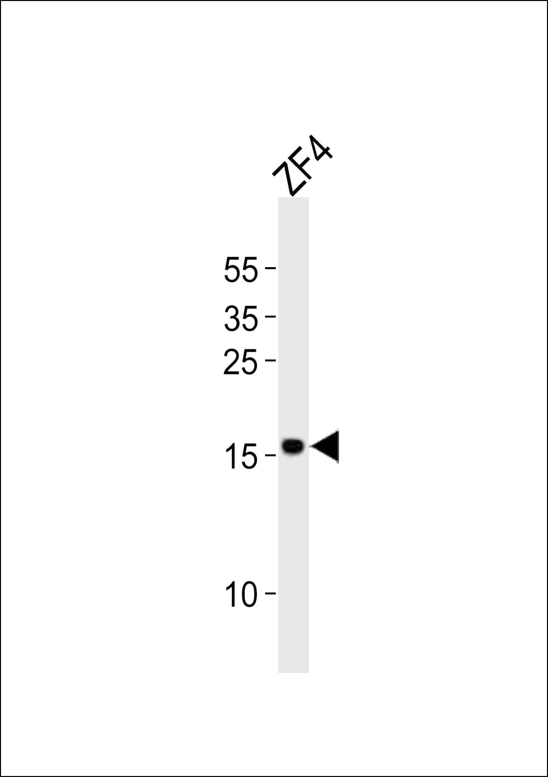 FUNDC1 Antibody (aa94-126)