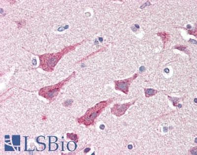 IHC-plus™ Polyclonal Rabbit anti-Human TUBA1A / Tubulin Alpha 1a Antibody (IHC, WB)