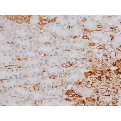 Polyclonal Rabbit anti-Human MAPT / Tau Antibody (phospho-Thr181, IHC, WB)