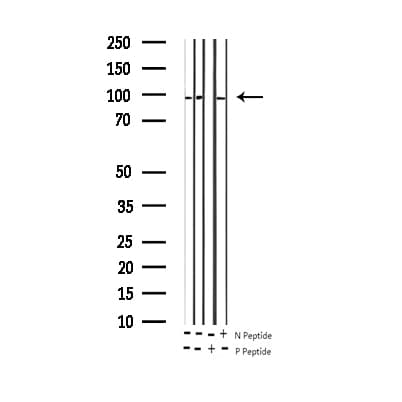 GRIA2 / GLUR2 Antibody (phospho-Ser880)