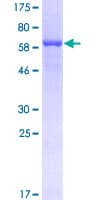 Human CLP1 Protein (Recombinant GST)