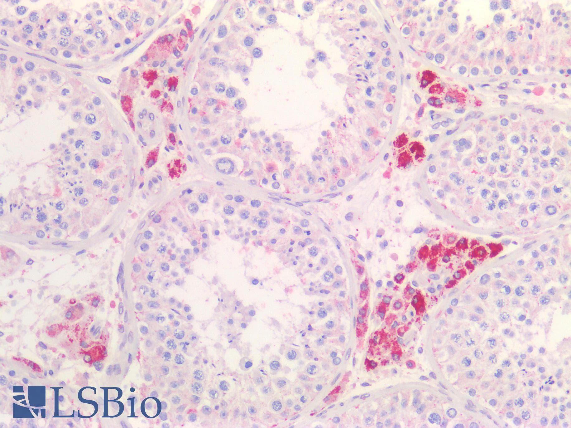 IHC-plus™ TNFRSF1B / TNFR2 Antibody (aa65-78)