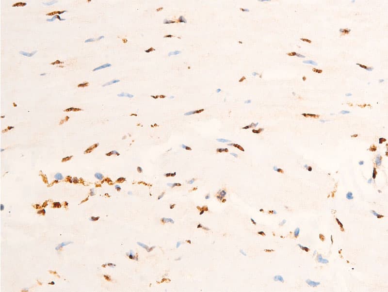 Polyclonal Rabbit anti-Human JUN / c-Jun Antibody (phospho-Thr91, IHC, WB)