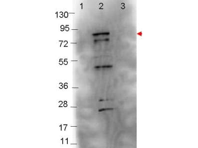 Polyclonal Rabbit anti-Borrelia burgdorferi fliC / Flagellin Antibody (Lyophilized, WB)