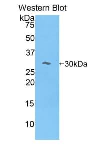 MYO1E / Myosin IE Antibody (aa781-1036)