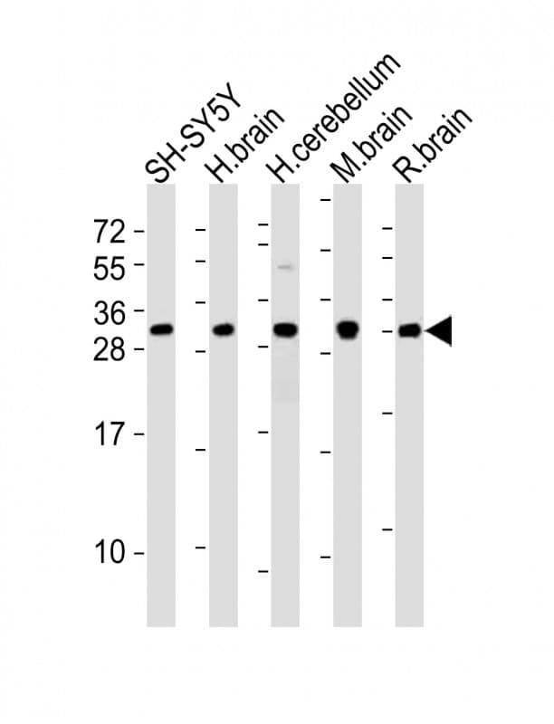 FGF14 Antibody (aa207-241)