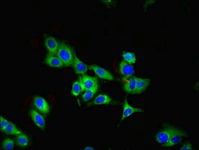 IHC-plus™ Polyclonal Rabbit anti-Human PARK7 / DJ-1 Antibody (IHC, IF, WB)