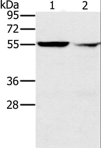 PPM1F Antibody