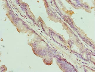 Polyclonal Rabbit anti-Human NOX5 Antibody (IHC, IF)